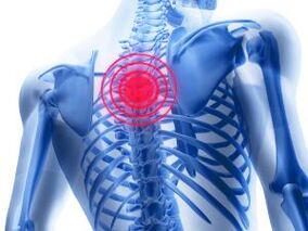 osteochondrosis ng rehiyon ng thoracic