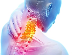 Servikal osteochondrosis