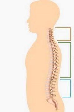 pagkatalo ng osteochondrosis ng iba't ibang bahagi ng gulugod